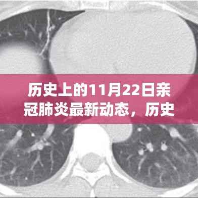 历史上的11月22日,探究新冠肺炎的最新发展动态与最新动态报告