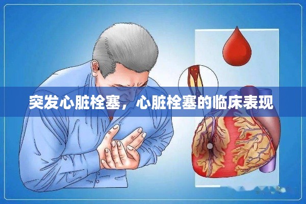 突发心脏栓塞，心脏栓塞的临床表现 