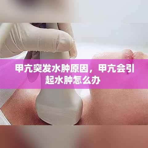 甲亢突发水肿原因,甲亢会引起水肿怎么办