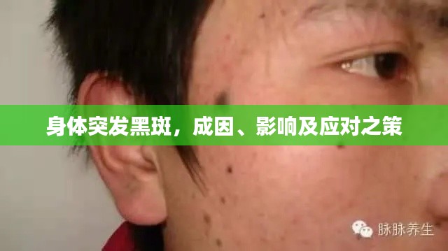 身体突发黑斑，成因、影响及应对之策