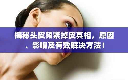 揭秘头皮频繁掉皮真相，原因、影响及有效解决方法！