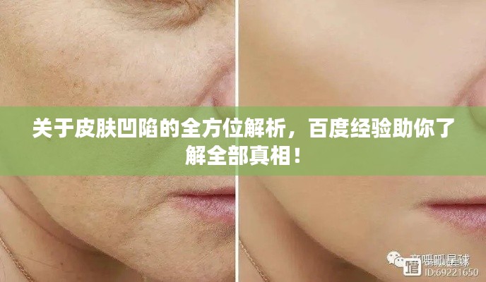 关于皮肤凹陷的全方位解析,百度经验助你了解全部真相!